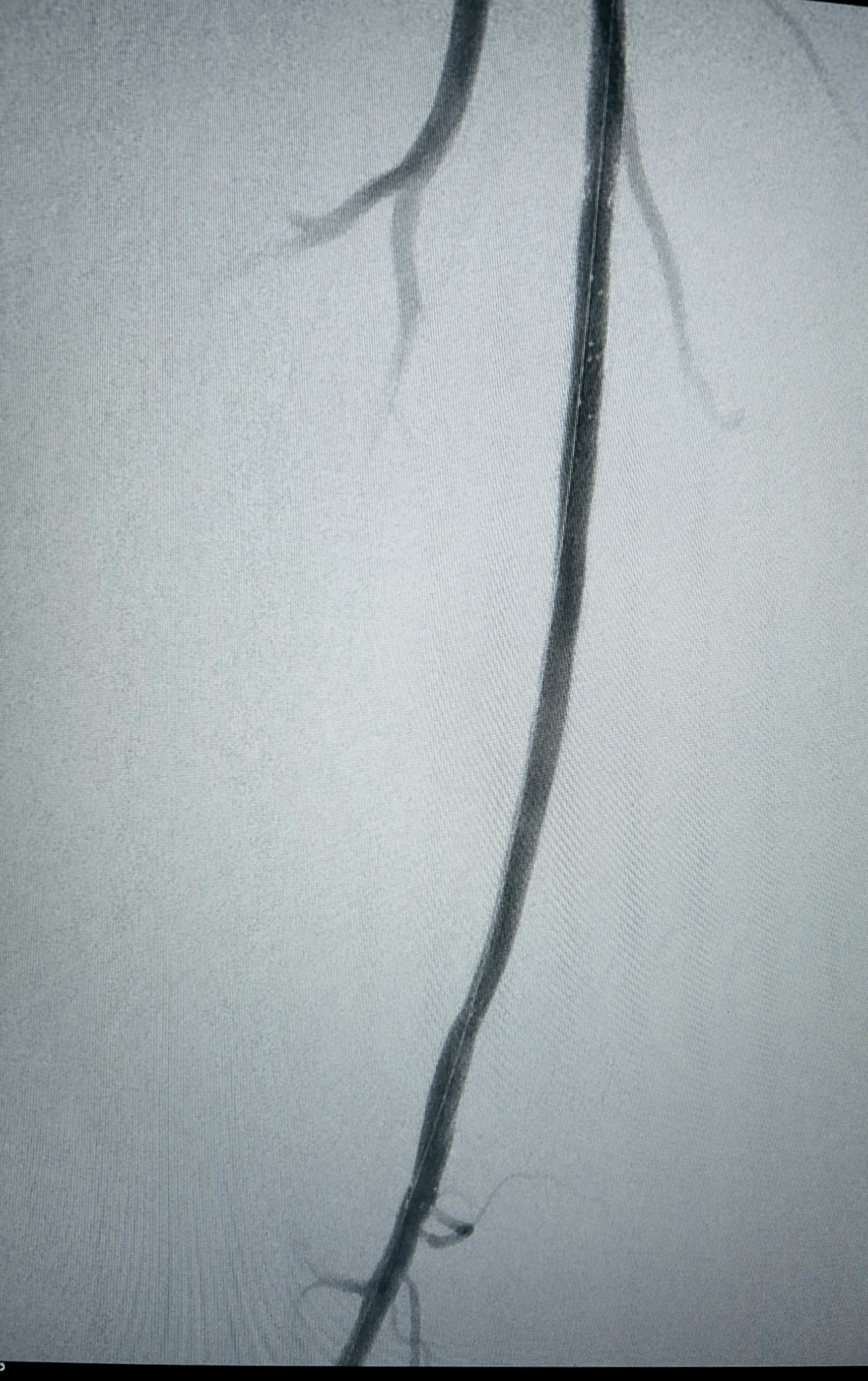 Cas 1 – Résultat final