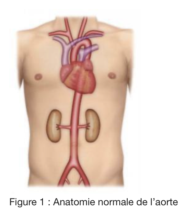 Échographie doppler de l'aorte