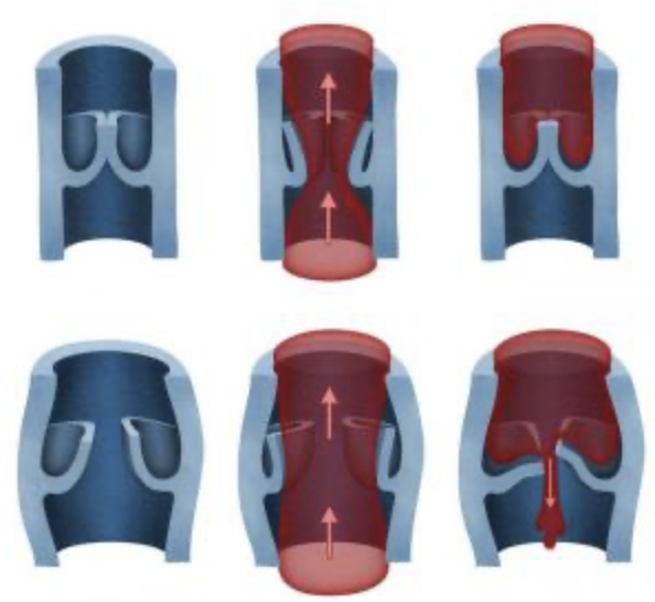 Mécanisme des varices